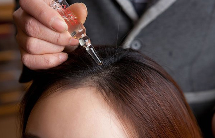 Scalp-Treatment